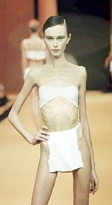 Anorexic-model